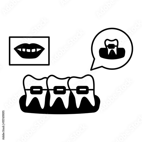 Teeth Aligners or metal wired braces with Before After smile concept, Lingual orthodontic treatment appliances vector design, Odontology symbol, manual dexteritysign, Dentist tools stock illustration