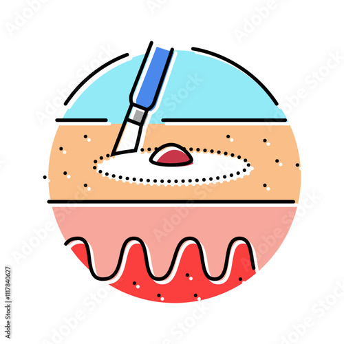 dilation and curettage surgery color icon vector. dilation and curettage surgery sign. isolated symbol illustration