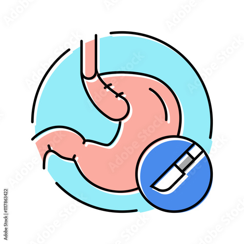 nissen fundoplication surgery color icon vector. nissen fundoplication surgery sign. isolated symbol illustration