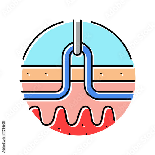percutaneous nephrolithotomy color icon vector. percutaneous nephrolithotomy sign. isolated symbol illustration