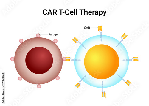 CAR (Chimeric Antigen Receptor) T cell therapy