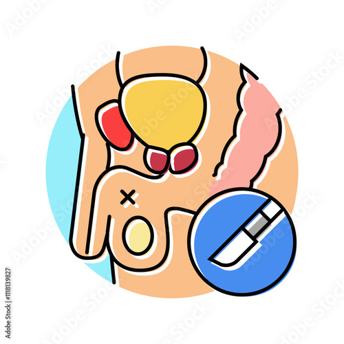 vasectomy urology color icon vector. vasectomy urology sign. isolated symbol illustration