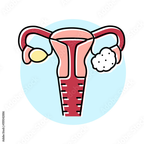 polycystic ovary syndrome woman disease color icon vector. polycystic ovary syndrome woman disease sign. isolated symbol illustration
