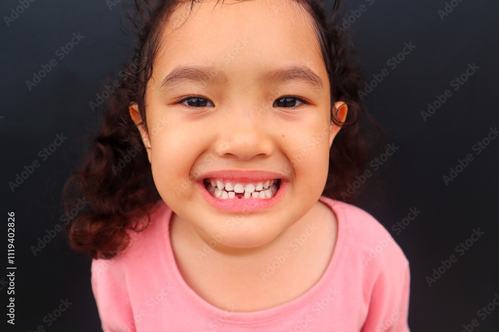 Portrait of Asian toddler girl smiling while showing missing teeth, close up.