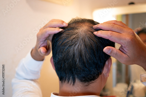 Canvas Print Man checks thinning hair in front of a bathroom mirror