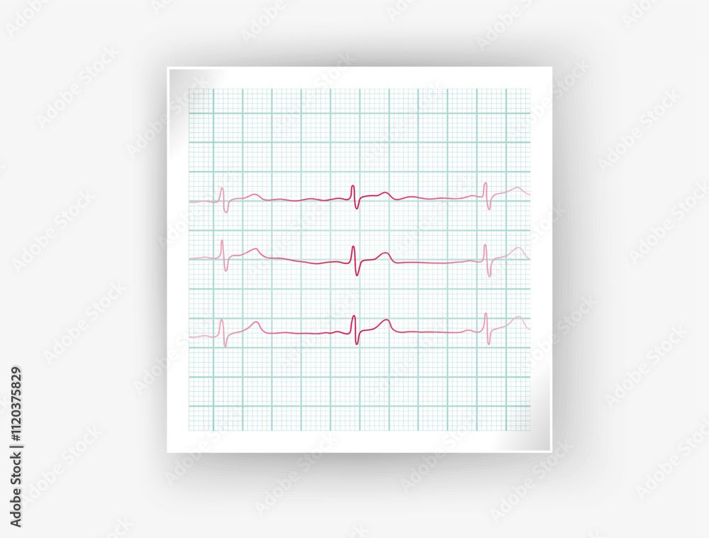 Heartbeat and Heart Rhythm Icon Set. ECG - EKG, Health Care Concept Vector Design vector format Heartbeat and Heart Rhythm Icon Set. ECG - EKG, Health Care Concept Vector Design vector format