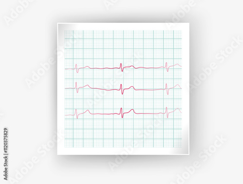 Heartbeat and Heart Rhythm Icon Set. ECG - EKG, Health Care Concept Vector Design vector format