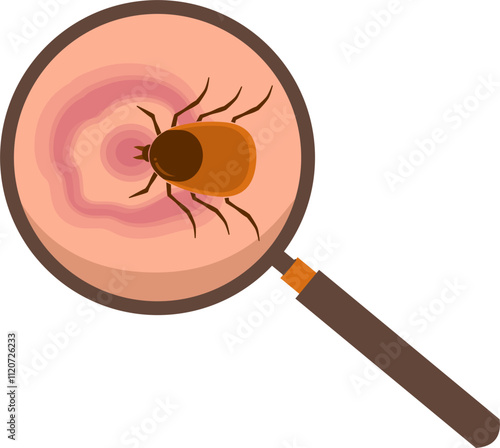Lyme disease Illustration 