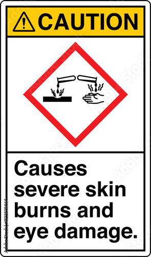 ISO 7010 Prohibition GHS Chemicals Label and Hazard Corrosive Causes severe skin burns and eye damage