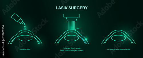 LASIK eye surgery