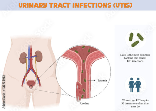 This figure is about urinary tract infections, which explains how bacteria from the skin or rectum travel up to the urethra and infect the urinary tract. E. coli is the most common bacteria that cause