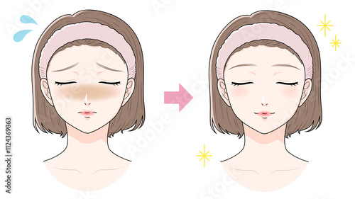 くすみに悩む前髪を上げた女性　ビフォーアフター　美容/肌トラブル