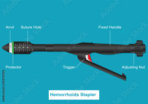 Hemorrhoids Stapler or stapled hemorrhoidectomy.