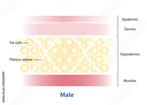 Diagram of Fibrous septae in men skin structure vector illustration on white background. The septae of men are oriented at 45° angles to the skin in a crisscrossing pattern, horizontally, diagonally.