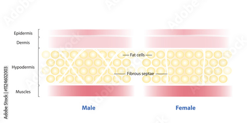 Diagram of gender differences in men and women skin structure vector illustration on white background. The fibrous septae of men run horizontally or diagonally, while in women run vertically.