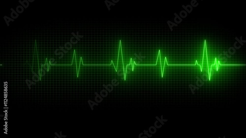Heart Rate Monitor Electrocardiogram Ekg Or Ecg Looping background. Medical monitor displaying cardiograph pulse checkup.