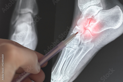 Obraz na plátne Doctor learning X-ray of foot fingers