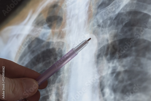 Behang X-ray scan of Human bones disease