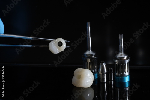 Expertise in jaw surgery and E-max and zirconium porcelain prostheses on dental implants. Screw-retained implant system. Dental prostheses and crown restoration treatment. dental before after
