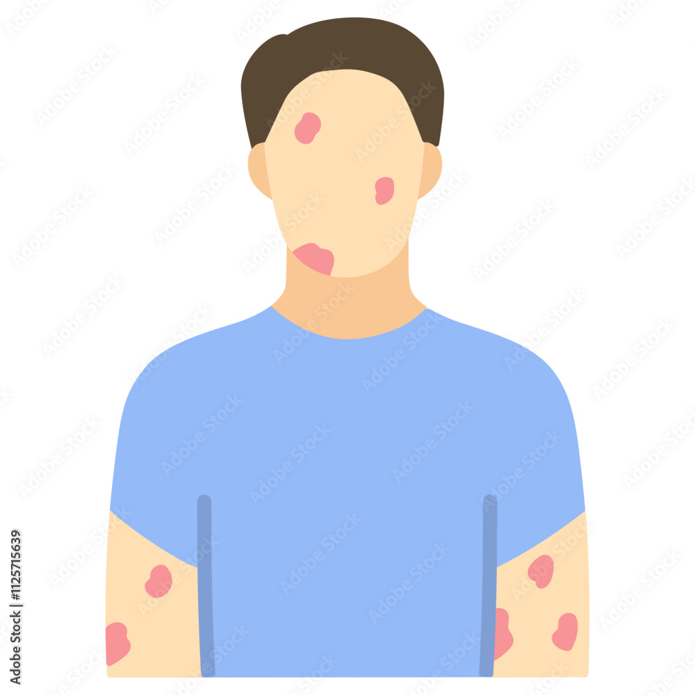 Allergy Flat Icon Vector Illustration Allergy Flat Icon Vector Illustration