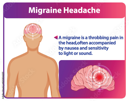 Understanding Migraine Headache Symptoms