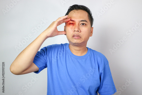 Young man touching his temple and having strong tension headache. Cluster headache. Man suffering from migraine, stress, hangover with red alert accent. Hands on head