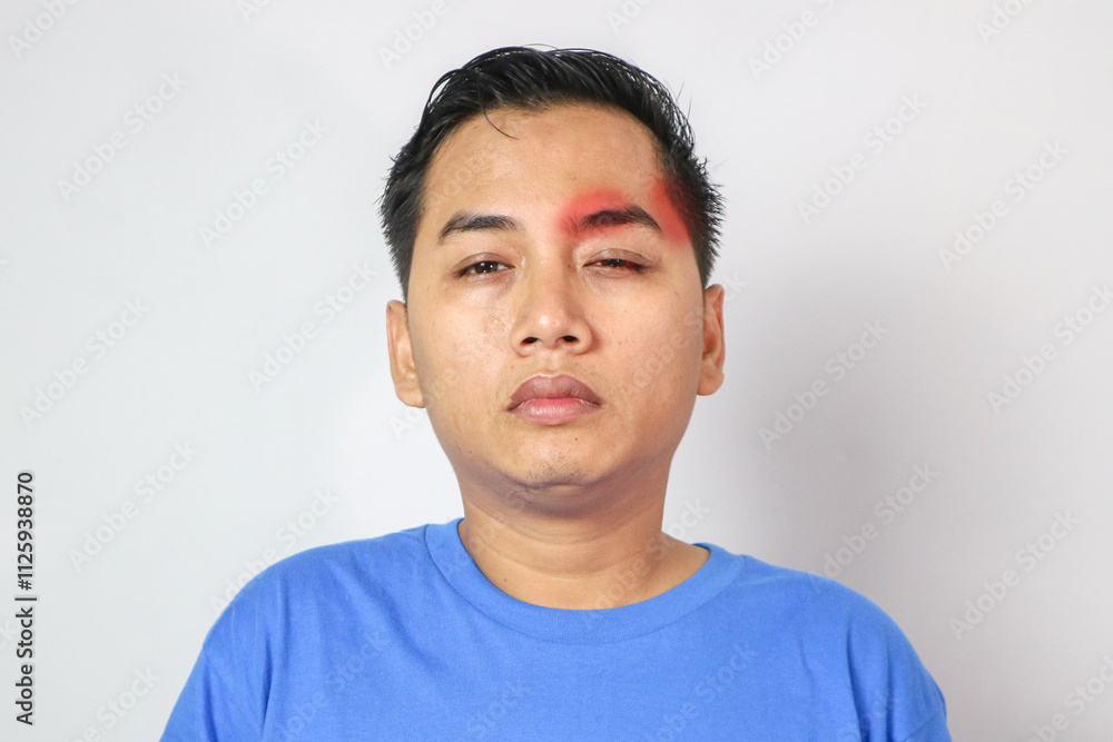 Obraz premium Head pain medicines pills concept. Cephalalgia and migraine. Man with sinus headache, tension or cluster headache on gray studio. Migraine symptoms. Chronic headaches. Headache triggers.