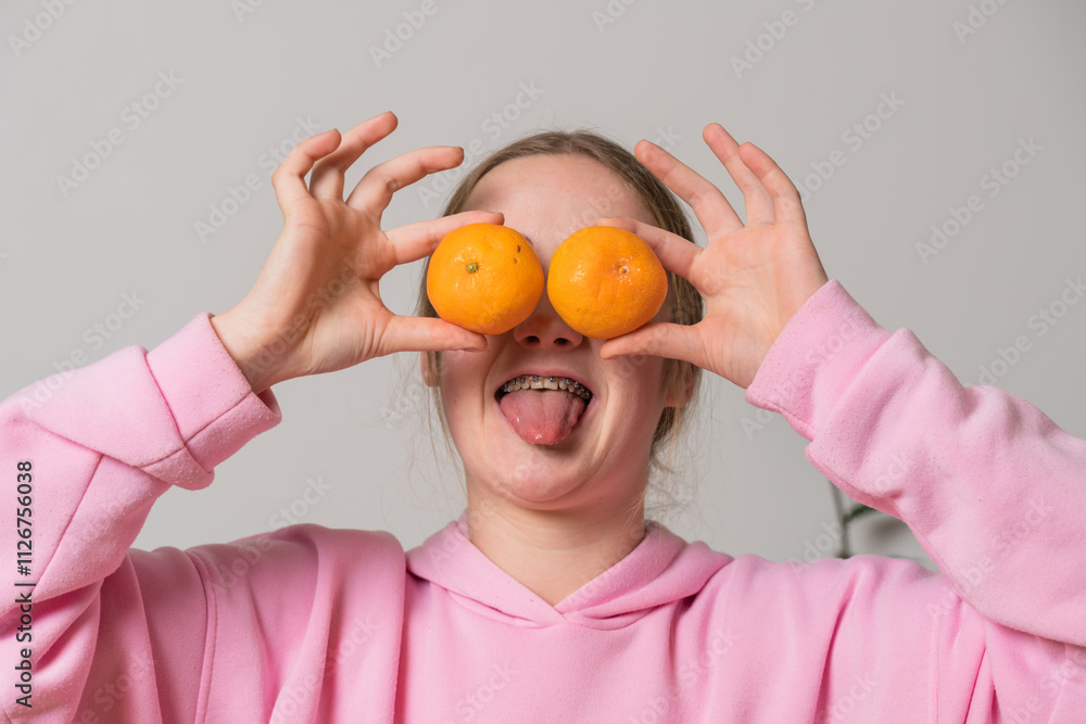 Woman with braces holds tangerines and has fun Woman with braces holds tangerines and has fun