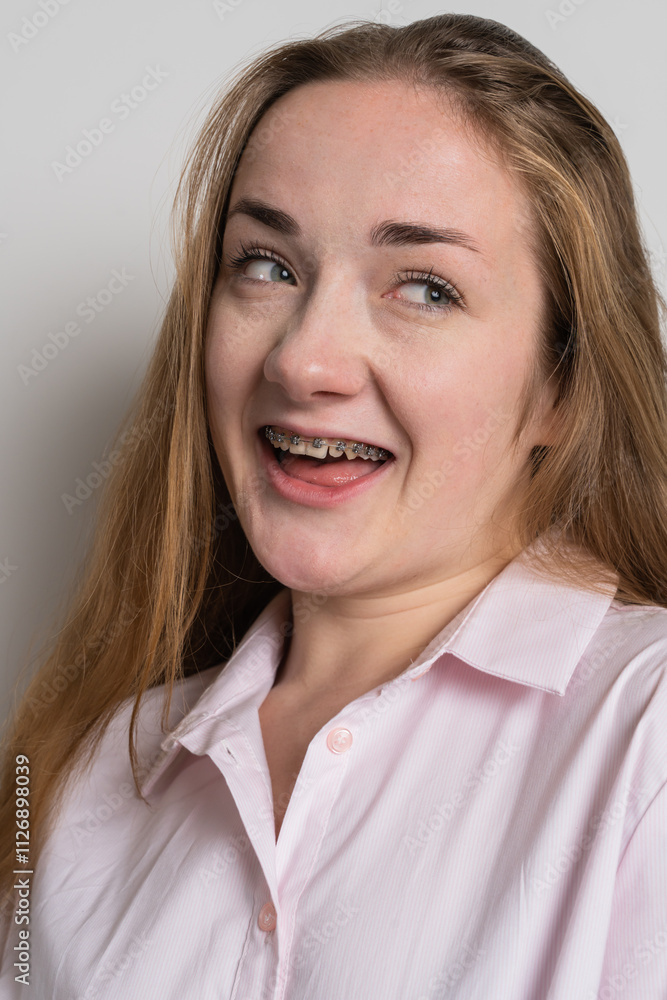Young woman after dental medical care Young woman after dental medical care