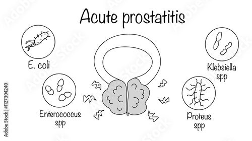 Acute prostatitis
