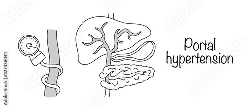 Portal hypertension