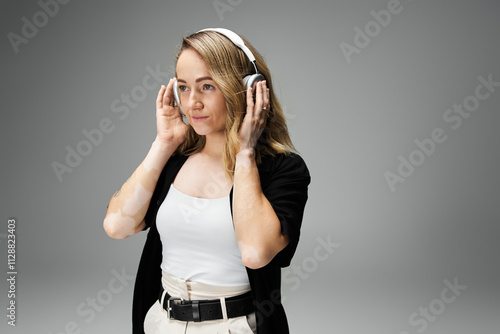 A young woman with vitiligo enjoys music with headphones in a minimalist setting. photo