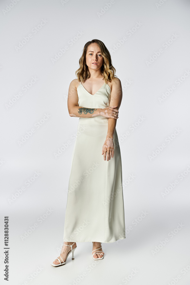 A young woman with vitiligo stands confidently in a simple studio, showcasing her beauty. A young woman with vitiligo stands confidently in a simple studio, showcasing her beauty.