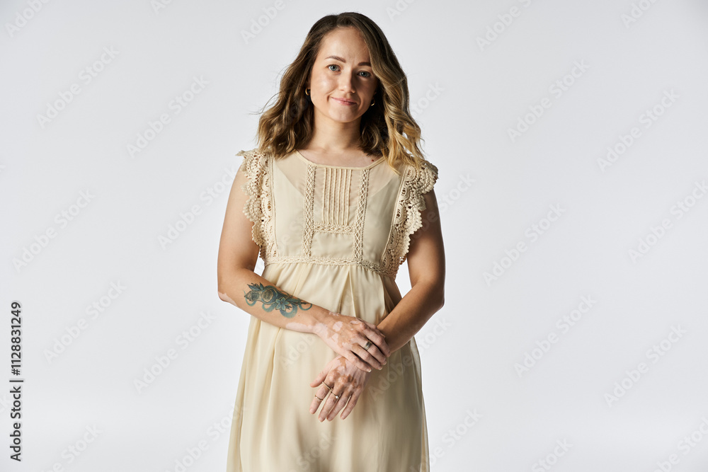 A young woman with vitiligo stands confidently, showcasing her unique beauty and style. A young woman with vitiligo stands confidently, showcasing her unique beauty and style.