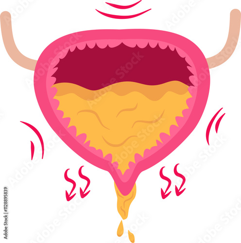 Overactive urinary bladder