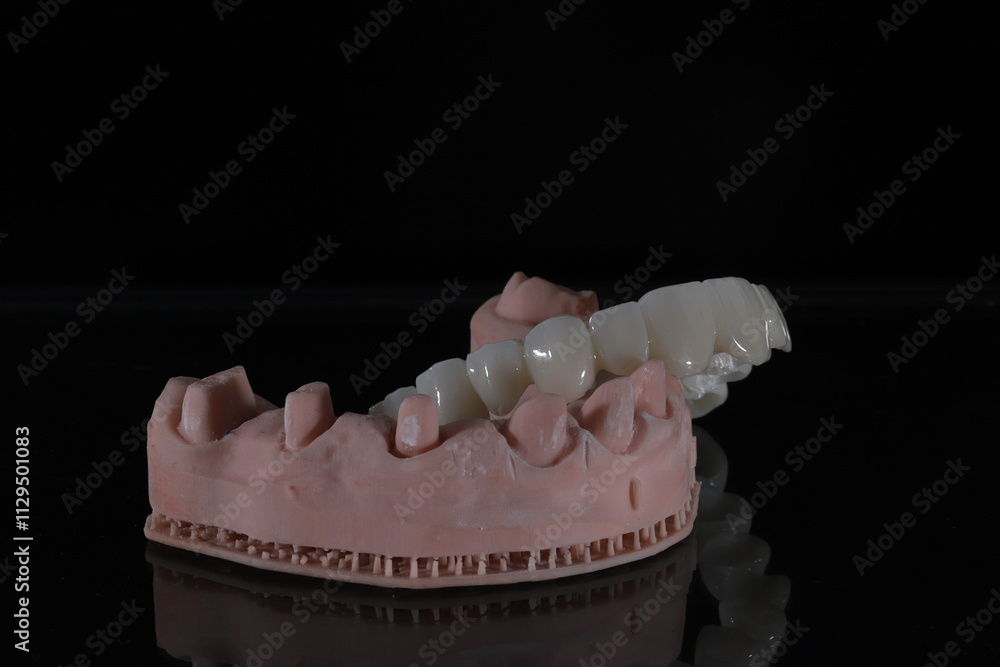 3D-printed jaw model and full-mouth zirconium porcelain crowns. Computer-assisted smile design treatment. dental before after.
3D-printed jaw model and full-mouth zirconium porcelain crowns. Computer-assisted smile design treatment. dental before after.