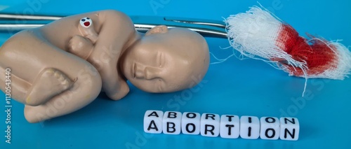 Cuadro en lienzo Surgical abortion and complex operation in clinic