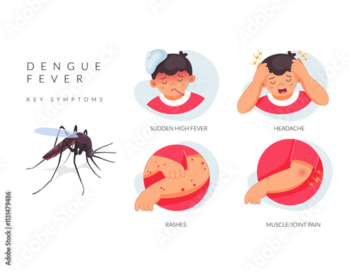 Dengue Fever - Key Symptoms in Chiildren - Stock Illustration