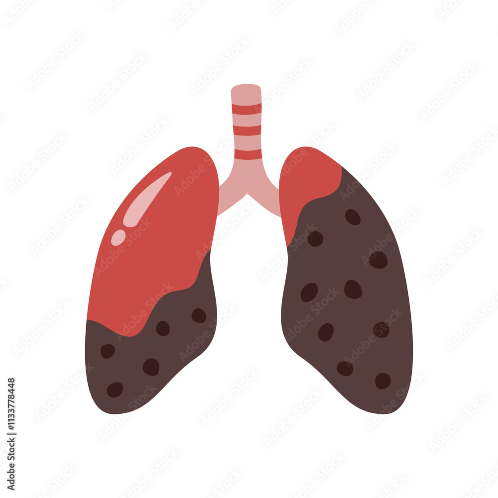 Damaged Lungs caused by air pollution, depicted in a vector illustration with dark patches symbolizing pollutants, smoking effects, and respiratory diseases Damaged Lungs caused by air pollution, depicted in a vector illustration with dark patches symbolizing pollutants, smoking effects, and respiratory diseases