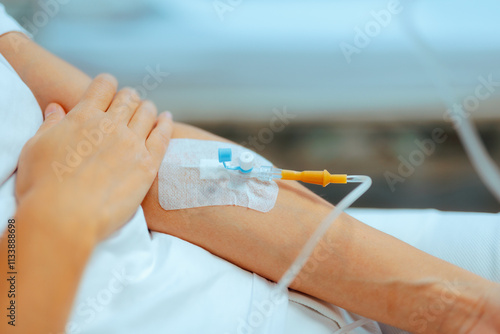 Konstfotografi Arm of a Patient with IV Cannula Hospitalized with Dehydration