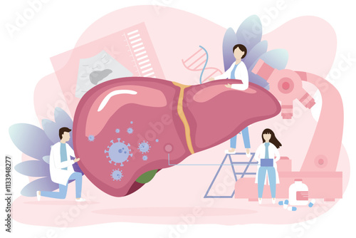  Liver diagnostics concept. Group of Doctors tiny people examine liver diagnostics. human organ, dangerous Liver virus, Hepatitis, cancer danger.Vector illustration. 