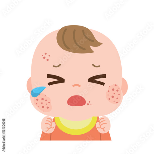 顔に発疹ができて泣く赤ちゃん　イラスト