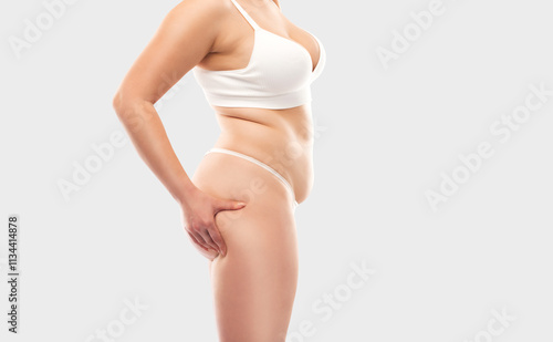 фотографія The girl stretches the skin on the leg and on the stomach, showing fat deposits