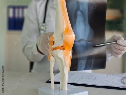 Bilde på lerret Orthopedic surgeon shows knee bone model Explaining to a patient about the treat