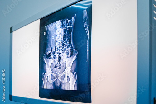 Obraz na płótnie Radiological examination to look for colon abnormalities. Medical image concept w salonie