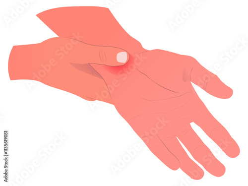 illustration of a sore wrist, suitable for medical professionals, or designers. suitable for use in brochures, infographics, websites, or social media posts.