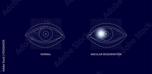 Square mesh with white dots on eye. Macular degeneration common. Normal and blurred vision. Causes loss of vision only central part the image. Medical science diagnosis. Vector EPS10.