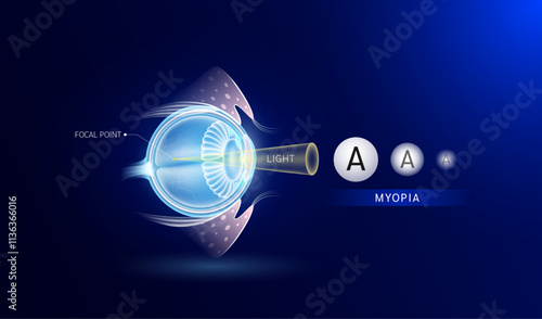 Myopia blurred vision. Seeing images up close is clear but distant objects are not clear or blurry. Human eye visual system anatomy. Medical science diagnosis. Vector EPS10.