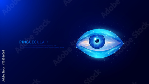 Small yellow bumps on cornea conjunctival lens. Pinguecula common eye diseases. Causes eye irritation and blurred vision. Medical science diagnosis. Human organ polygon on dark background. Vector.