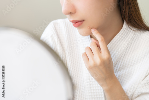 Expression worry asian young woman hand touching pustule around the chin and mouth, allergic when wear mask, makeup, show squeezing pimple spot from face. Beauty care, skin problem by acne treatment.